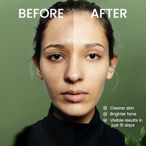 CLEAR COMPLEXION MINI KIT - Flawless skin in 15 days