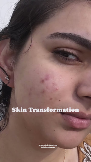CLEAR COMPLEXION MINI KIT - Flawless skin in 15 days
